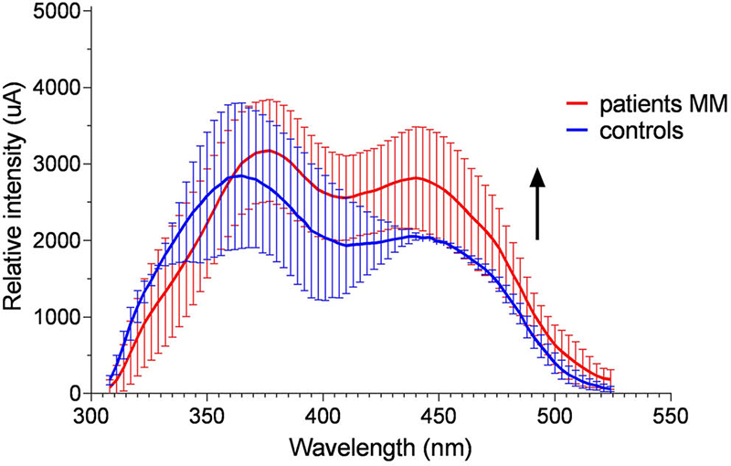 Fluorescence spectroscopy of urine monitors skin cancer progress