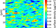 Distribution of Ca, S and Fe in a section of diffuse astrocytoma. Image: Diamond Light Source Distribution of Ca, S and Fe in a section of diffuse astrocytoma. Image: Diamond Light Source
