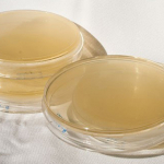 Photo of agar plates